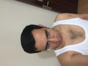 3650-grafts-hair-transplant (17)