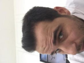 dr-kul-hair-transplant-result (30)