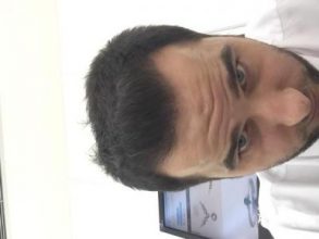 dr-kul-hair-transplant-result (33)
