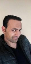 zekeriya-kul-hair-transplant-results (13)