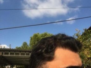dr-koray-erdogan-hair-transplant (1)