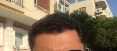 dr-koray-erdogan-hair-transplant (22)