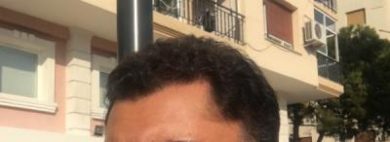 dr-koray-erdogan-hair-transplant (24)
