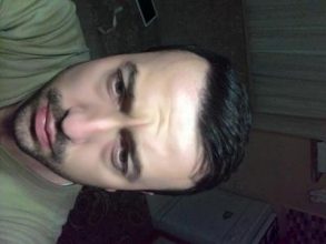 hair-transplant-line (1)