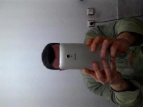 hair-transplant-line (22)