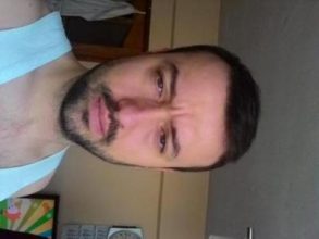 hair-transplant-line (23)