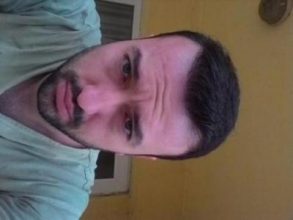 hair-transplant-line (25)