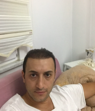 estemylife-hair-transplant