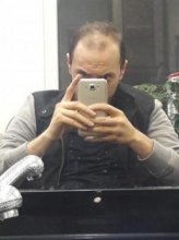 estemylife-hair-transplant