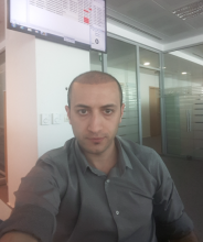 estemylife-hair-transplant