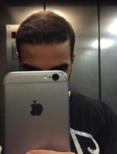 izmir-turkey-hair-transplant
