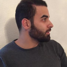izmir-turkey-hair-transplant