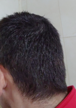 serkan-aygin-3830-grafts