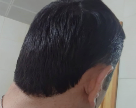 serkan-aygin-3830-grafts