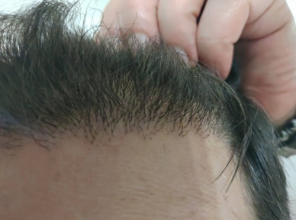 serkan-aygin-3830-grafts