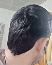 serkan-aygin-3830-grafts