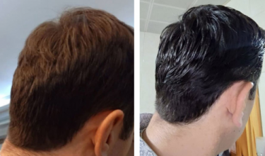 serkan-aygin-3830-grafts