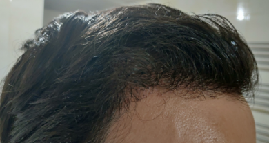 serkan-aygin-3830-grafts