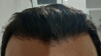 serkan-aygin-3830-grafts