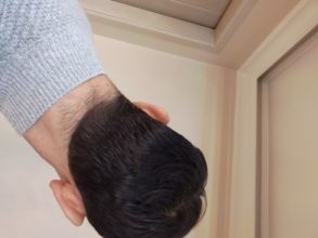 serkan-aygin-3830-grafts