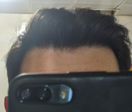 serkan-aygin-3830-grafts