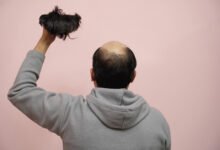 Man holding a hair replacement wig